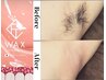 【清潔感爆上 即ツルツル】　匠道ワックス★脇脱毛　初回4400円