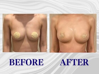 ザモア 福岡天神(THE MORE)/【症例 Before After】