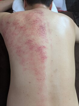 リデザイン 京都(REDESIGN)/