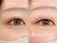 ノマン(Knoman)/エクステパーマ100本☆