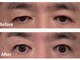 美容の宝石箱の写真/＼男性大歓迎！男性多数ご来店あり◎／【大通駅すぐ】どんな肌悩みも酷い眼精疲労も当店にお任せください！