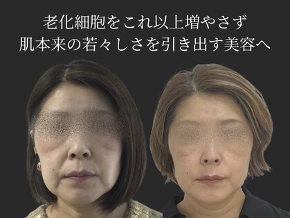 ミヨン(miyong)の写真