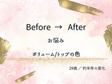 ロットプラス(Lot Plus)/Before→After【20代のお客様】