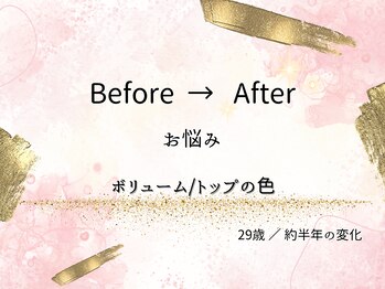 ロットプラス(Lot Plus)/Before→After【20代のお客様】