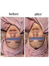 KMB 中崎町店/ワイコォーピーリング　