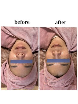 KMB 中崎町店/ワイコォーピーリング　