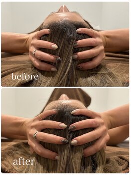 チル(chill)/頭蓋骨矯正