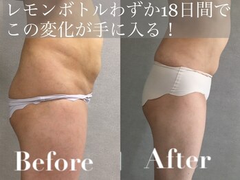 ニュイブラーシュ(nuit blanche)