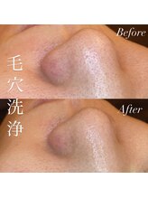 アース コアフュールボーテ 新潟紫竹山店(EARTH coiffure beaute)/毛穴洗浄