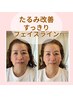 【人気NO.1】シワ改善&頬のたるみ改善フェイシャル◆ハーブピーリング