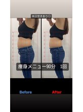 リリット/本格痩身。骨格にアプローチ。