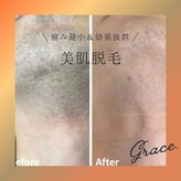 グレイス(Grace)