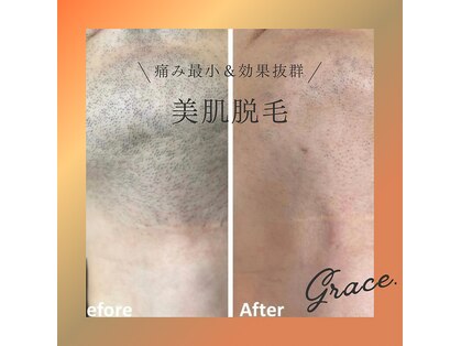グレイス(Grace)の写真