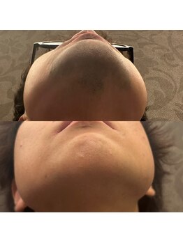 フェリーバ 流山店(FELIVA)/最短回数で抜いていきます。