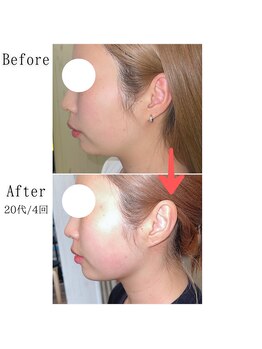 グラシア(gracia)/シミ・毛穴ケア専門店gracia