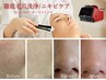 【ニキビ予防　皮脂や毛穴洗浄】REVIPRO &nbsp;&nbsp;ダーマハイドロ　¥8800