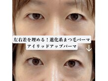 プリティアイ(pretty eye)