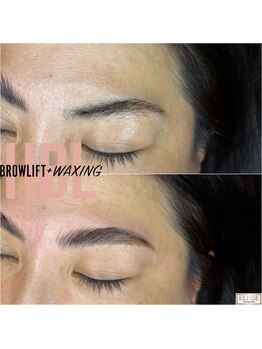 エリス(ELISSE)/HBLで自眉自在