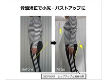 サロンブルー(Salon Blue.)/骨盤矯正ビフォー・アフター