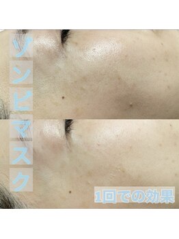 リリーブー 池袋(Lilyboo)/ゾンビマスク