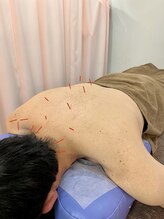 ことぶき整骨院/鍼灸施術