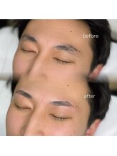 レアファースト/メンズハリウッドブロウリフト