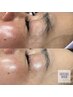 芸能人もやってる！マリムーブフェイシャルワックス　モチモチツヤツヤ卵肌！