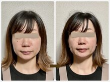哲心 姫路