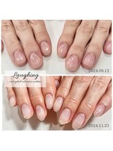 ラフィング(Laughing)/自爪育成