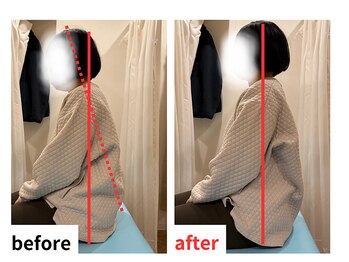 四条大宮アシスト鍼灸整骨院/全身整体ビフォーアフター