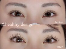 ユーロ(EURO)/アンドヘルシー