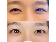 グロウビューティー(grow beauty)/