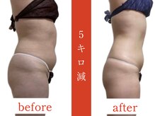 ウィズルーチェ 神栖店(with luce)/痩身効果★ダイエットに終止符を