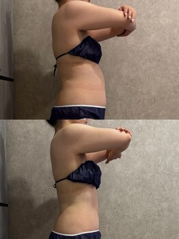 トータルビューティー ミミ(Total Beauty mimi)の写真/年齢とともに崩れたライン、整えませんか？
