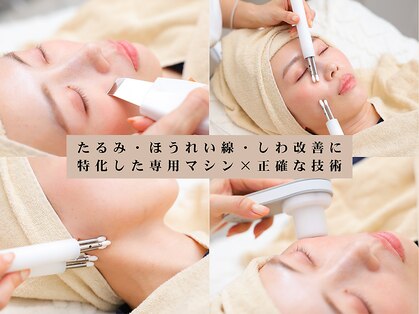 ミラーレ(Mirare)の写真