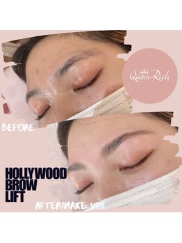 クィーンリッチ(Queen-Rich)/美眉【ハリウッドブロウリフト】