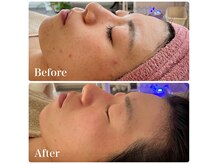 マイスタイル(My style Beauty)