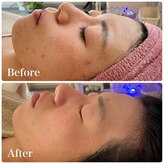 マイスタイル(My style Beauty)