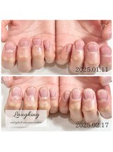 ラフィング(Laughing)/自爪育成