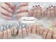リノ ネイル(Rino nail)の写真