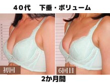 バストサロン メルベイユ(Merveile)/バスト位置・ボリューム・谷間UP