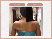 ソウイボディ 武蔵小杉店(Sou-i body)/ブライダルbefore→ after