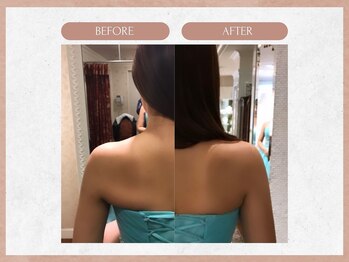 ソウイボディ 武蔵小杉店(Sou-i body)/ブライダルbefore→ after