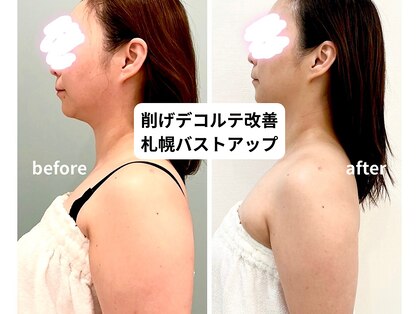 リソラ(risora)の写真