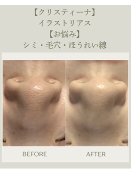 エヌア(nA)の写真/当店は天然ハーブ使用の《ビオフィート》や剥離系ピーリング《ローズドメーラ》など毛穴のお悩みに特化◎