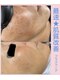 ミラビューティー(Mira Beauty)の写真/シミ・くすみ・毛穴のお悩みに◎無料肌診断付きプラズマ肌管理