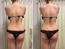 レイル(REIR)の雰囲気（オールハンド痩身全身90分★1回でこの変化◎左:施術前/右:施術後）