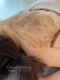 クリーンアンドビューティ 札幌(Clean&Beauty)の写真/背中ニキビにお悩みの方に◎顔周りだけじゃなくセルフケアでは難しい背中ケアもハーブピーリングにお任せ☆