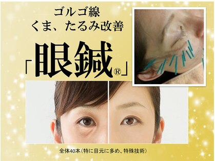 ハリス(HARIS)の写真