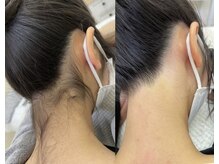 ヴィアージュ/剃らなくていいうなじ脱毛